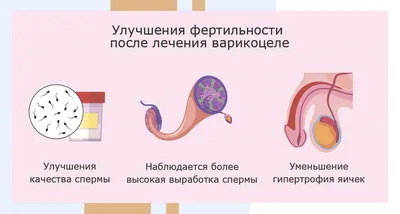 Влияет ли варикоцеле на бесплодие - какая связь?