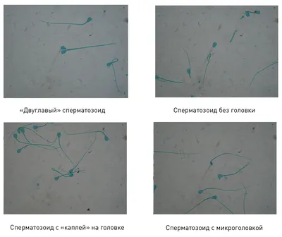 Чем можно заразиться при поцелуе