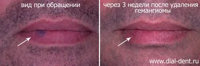 Впервые в Могилеве: специалисты удалили огромную опухоль с лица пациента -  Могилёвская Областная Клиническая Больница