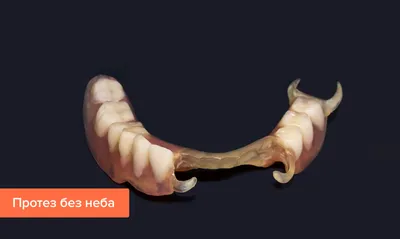 [35+] Верхний съемный зубной протез без неба фото