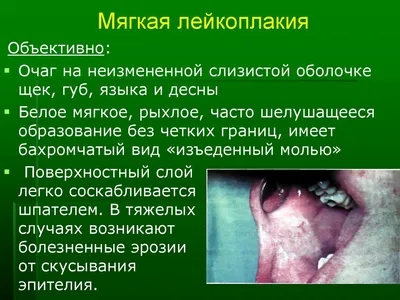 Клинический случай комплексного лечения веррукозной формы лейкоплакии  слизистой оболочки рта с применением лазерной абляции и препаратов на  основе коллагена - Медалфавит