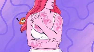 Как выглядит дерматит и что делать, если у вас что-то похожее –  Медиа-Полесье – новости и реклама Пинска, Лунинца, Столина