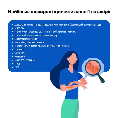 Алергія на шкірі: лікування, симптоми | doc.ua