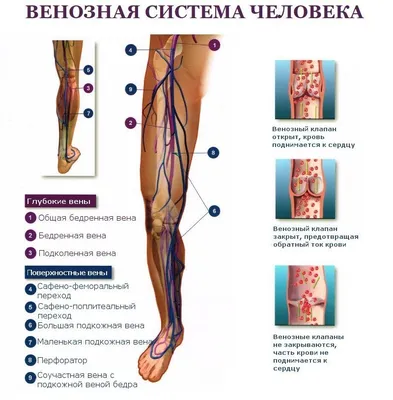 Тромбофлебит поверхностных вен нижних конечностей - online presentation