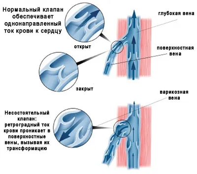 Флебология