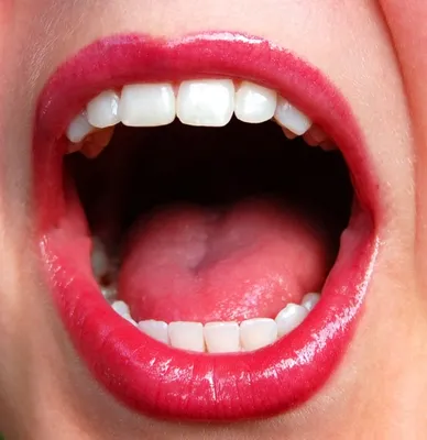 Воспаление под языком | Семейная стоматология