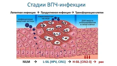 DIMED Medical Center - Папилломавирус человека – симтомы и лечение  Папиллома – сосочковые разрастания на коже и слизистых оболочках. Особого  внимания заслуживают папилломы, вызванные вирусами с высоким онкогенным  риском (ВПЧ 16,18, 45,