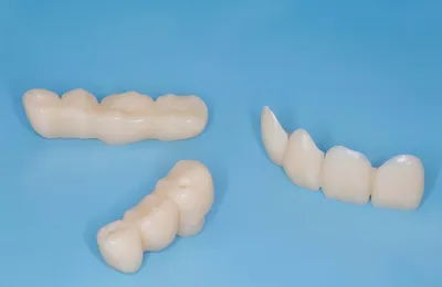 Пластмассовые коронки на передние зубы: цена, временные пластмассовые  коронки в Спб