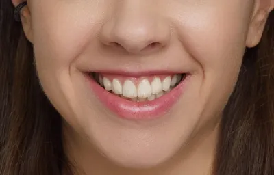 Пластмассовые коронки на зубы в Москве недорого - цены от 2500 р на  установку пластиковых коронок | клиника «Зубная Формула» на Тимирязевской