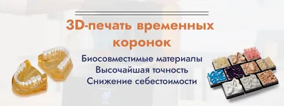 Почему нельзя поставить постоянную коронку сразу? Ситуации, когда без  временных коронок не обойтись | ortodontcomplex.ru | Дзен