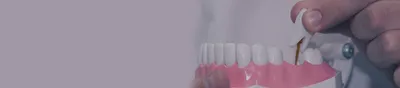 Пластмассовые коронки на зубы в Москве – цены, отзывы на установку  пластиковых коронок в стоматологических клиниках Зуб.ру