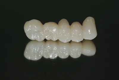 Пластмассовые (композитные) зубные коронки в Краснодаре