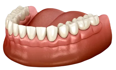 Протезирование зубов в Тюмени, зубные протезы, цены | «ЮниДент» - ЮниДент