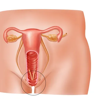 Вульвит. Диагностика и лечение вульвита в Челябинске.