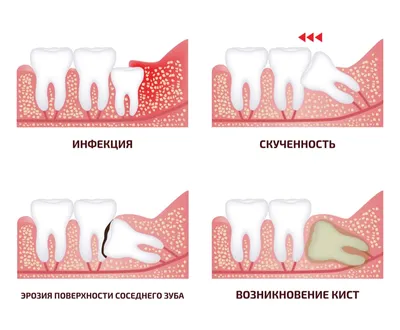 Имплантация зубов в Киеве – Стоимость и отзывы ᐈ Certus | Certus