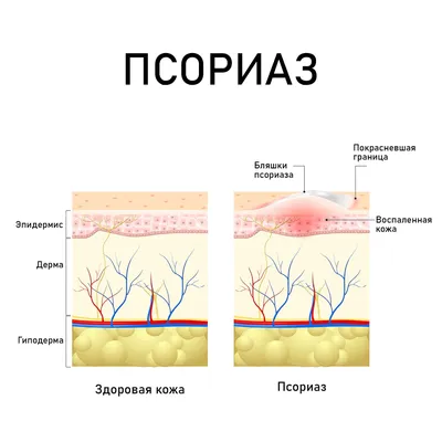 Пупырышки на половом члене - причины и лечение в СПб | Клиника МедПросвет