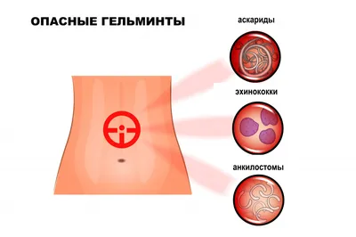 Как я пытаюсь победить экзему | Пикабу