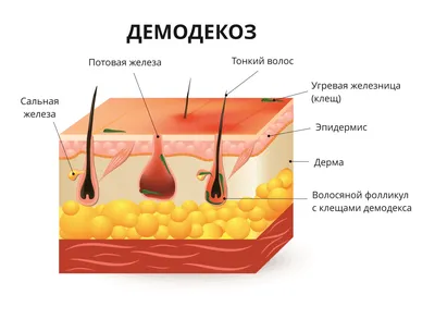 Крапивница — Википедия