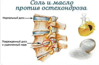 Висипання на шкірі при глистах, фото, висип на обличчі і тілі при гельмінти  у дітей, шкірні симптоми (ознаки) гельмінтозу, шкірні висип при глистах