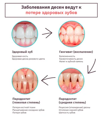 Лечение дёсен в Москве | Клиника \"МАЙ\"