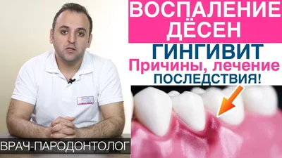 Лечение десен (пародонтит, гингивит) | Drgrossu.md