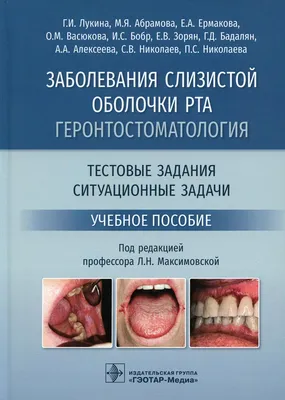 Бишофит при воспалительных заболеваниях слизистой оболочки полости рта