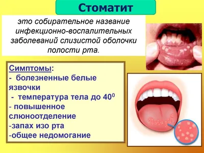 Неделя ответственного отношения к здоровью полости рта