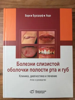 ЗАБОЛЕВАНИЯ СЛИЗИСТОЙ ОБОЛОЧКИ ПОЛОСТИ РТА У ДЕТЕЙ