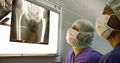 Операция по замене тазобедренного сустава в Анталии, Турция | Cayra Clinic