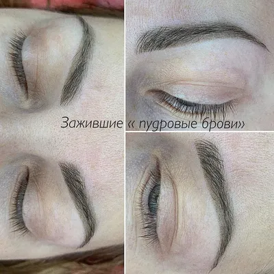 Как заживают пудровые брови: подробное описание этапов по дням с фото -  блог PermanentProfy - Permanent Profy