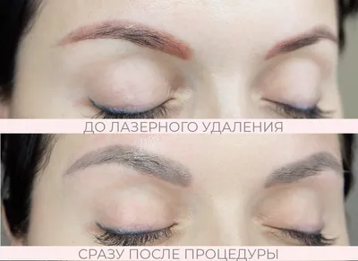 Правильный уход за бровями после пудрового напыления