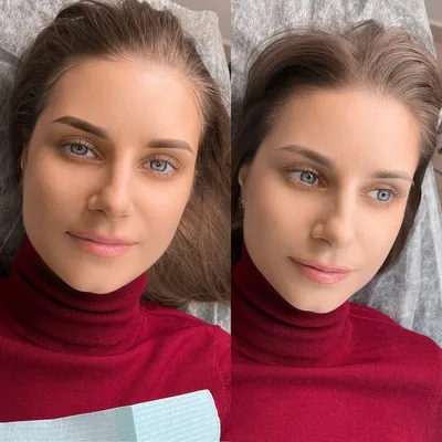 Какими бывают последствия татуажа: фото | Kramer PMU Studio