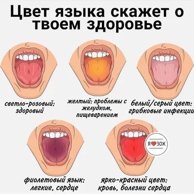 О чем говорит цвет языка | Бери и Делай | Дзен