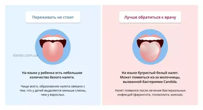 👅 Белый налет на языке. Клинический случай №386 - YouTube