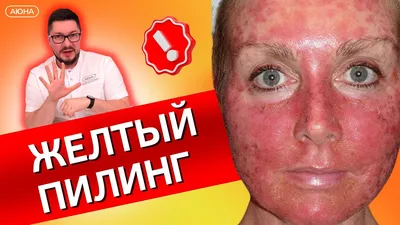 Желтый пилинг Mediderma Retises CT Yellow Peel набор на 1 процедуру -  купить в интернет-магазине по выгодной цене