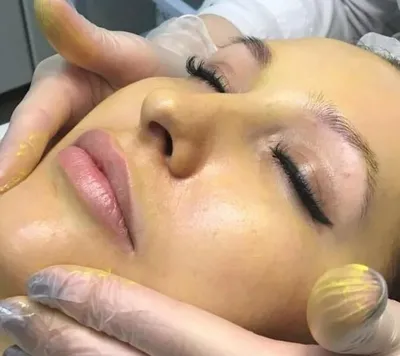 Желтый пилинг для лица ретинол 5% Yellow Peel BTpeel 15833893 купить за 1  195 ₽ в интернет-магазине Wildberries