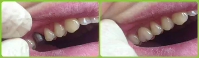 APEX - Stomatology - \"ЗУБНАЯ МОДА\" НАРОДОВ МИРА В разных культурах «зубная»  мода отличается от европейской. Устанавливать золотые коронки на зубы —  довольно распространенная практика. Едва ли можно встретить жителя Средней  Азии