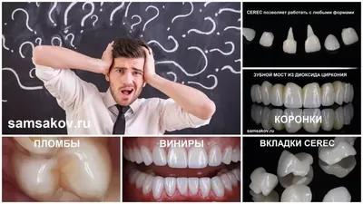 Восстановление зуба: что выбрать пломбу, вкладку или коронку - советы  ортопеда, Москва