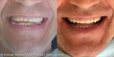 Стоматология Саратов: 39 фото до и после
