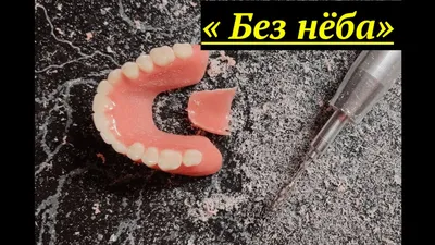 Верхний зубной протез: цена, виды протезов на верхнюю челюсть | НоваДент