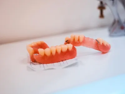 Съёмный, частично съёмный зубной протез на нижнюю челюсть – Denta-Labor