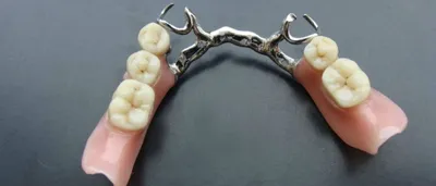 Протезы для зубов съемные на крючках