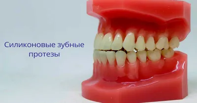 https://smile-academia.ru/service/protezirovanie/semnye-protezy