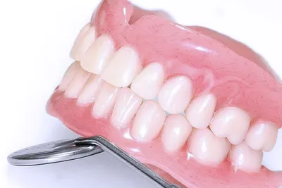 Съемные зубные протезы – замещение зубов без боли Минск