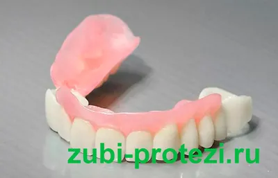 Бюгельное протезирование зубов в СПб - цена на бюгельный протез, отзывы о  процедуре