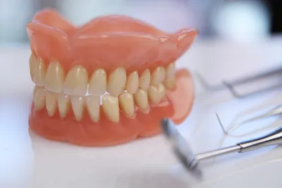Новое поколение зубных протезов без неба: виды, фото и отзывы -  Стоматология Эспадент