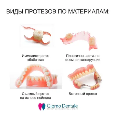 🦷 Протезирование зубов ☑ Стоматология в Киеве и Львове ☑ Giorno Dentale