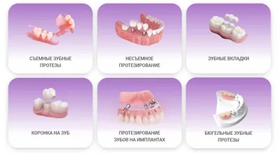 ᐈ Съемные зубные протезы в Запорожье • Цены • Съемное протезирование ⇒  Nikolov Dental Clinic