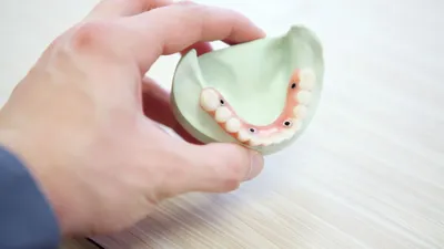 Протезы для зубов