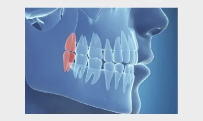 Человек показывая рот без зубов Стоковое Фото - изображение насчитывающей  подбородок, сторона: 68112802